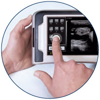 Ультразвуковые сканеры